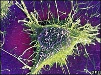 priones-fuente-salud-futura