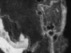 o_mapa nanoscala som microagregado