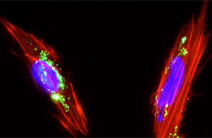 Clulas mesenquimales de placenta con nanopartculas de slice mesoporosa internalizadas en su citoplasma. / Juan Luis Paris