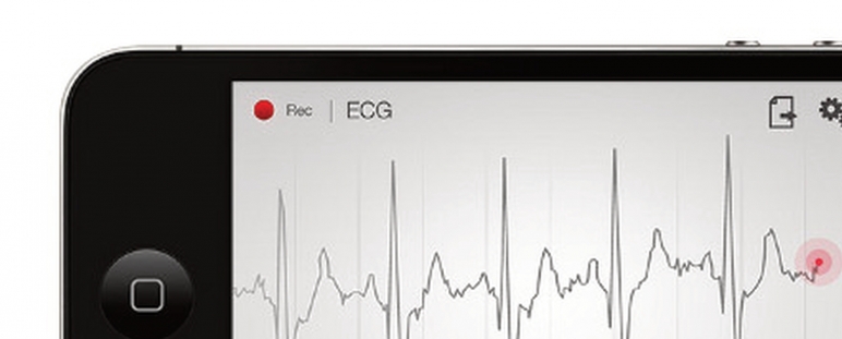 App de interpretación de ECG