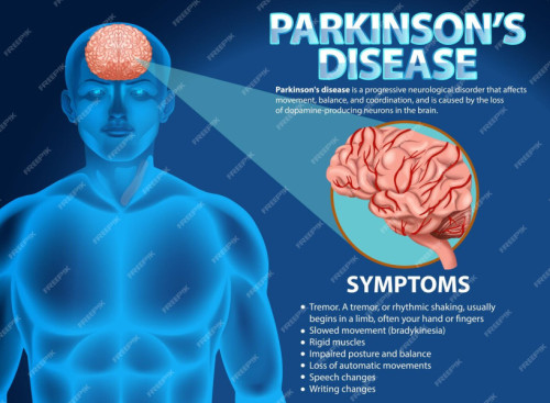 Cartel informativo enfermedad de Parkinson