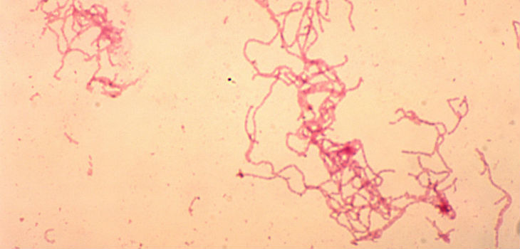 Fotomicrografía de cultivo de sangre de conejo de la bacteria Haemophilus ducreyi usando la técnica de tinción de Gram. / CDC/ Dr. Greg Hammond
