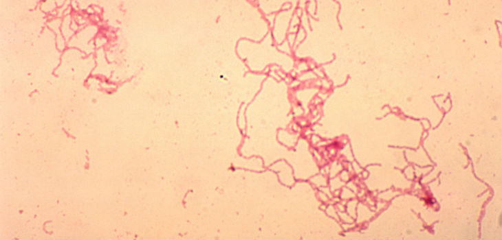 Fotomicrografía de cultivo de sangre de conejo de la bacteria Haemophilus ducreyi usando la técnica de tinción de Gram. / CDC/ Dr. Greg Hammond