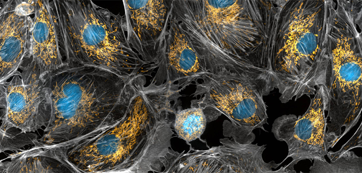 Células de vaca tomadas con un microscopio, las mitocondrias se tiñeron en amarillo brillante para visualizarlas en la célula. Los grandes puntos azules son los núcleos de las células y la red gris es el citoesqueleto de las células. / Torsten Wittmann, University of San Francisco/NIH Image Gallery (FLICKR)