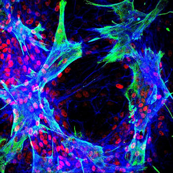Imagen de inmunofluorescencia que muestra células estrelladas hepáticas primarias humanas que interactúan con células progenitoras hepáticas bipotentes in vitro. Los cultivos se marcaron utilizando anticuerpos contra vimentina (verde), HNF4a (rojo) y se trataron con faloidina (azul). El estudio mostró que la diferenciación de las células progenitoras se localizó en los sitios de contacto entre los dos tipos de células. / CIBERDEM