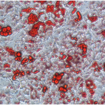 Adipocitos en cultivo, las gotadas lípidicas aparecen teñidas de rojo. / Nuria Matesanz-CNIC