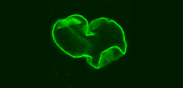 En pacientes con HGPS, el núcleo celular tiene una morfología aberrante. / Paola Scaffidi et al. Plos Biology. DOI: 10.1371/journal.pbio.0030395 (WIKIMEDIA)