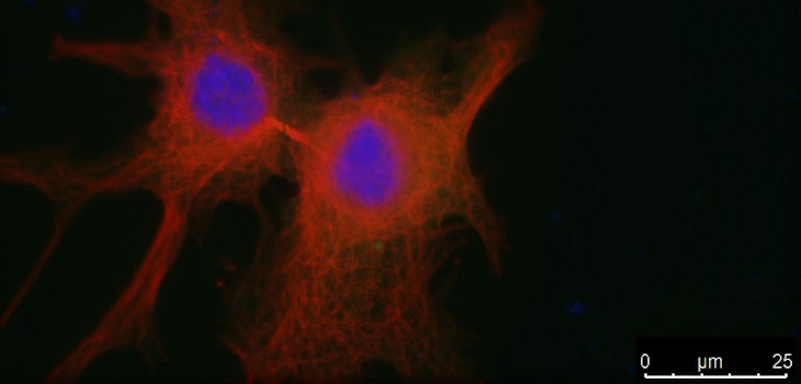 La sobreexpresión de PLK1 provoca un defecto en la separación de las células después de su división, impidiendo la proliferación celular y el crecimiento tumoral. / CNIO