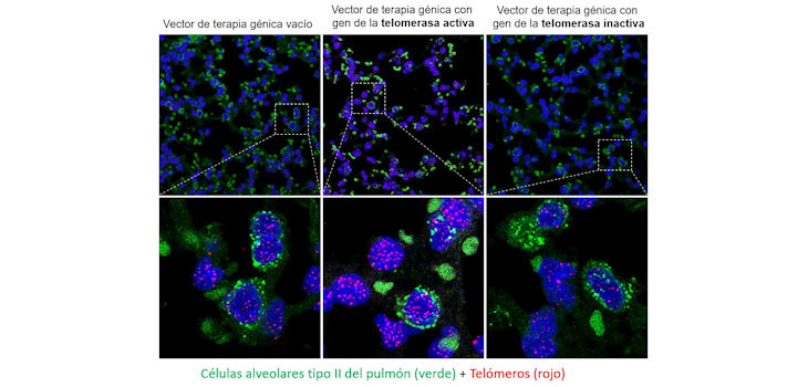 Imágenes de pulmones tratados con los vectores de terapia génica en las que se observan los núcleos de las células en azul, las células alveolares en verde y los telómeros en rojo. Se observan que los telómeros de las células de pulmón a los que se les ha tratado con la telomerasa activa son más intensos indicando mayor longitud telomérica que las células de pulmones tratados con los vectores vacíos o con la telomerasa inactiva. /CNIO