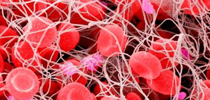 Imagen de microscopía de un trombo sanguíneo. / IQAC