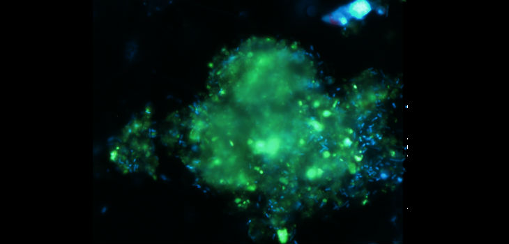 Partícula marina con bacterias (en azul) al microscopio. / Mireia Mestre-CSIC 