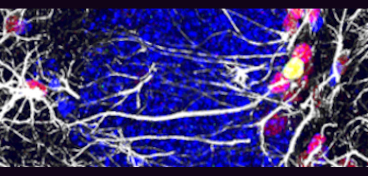 Descubren cómo reducir la pérdida de células madre relacionada con el envejecimiento en el cerebro de ratones