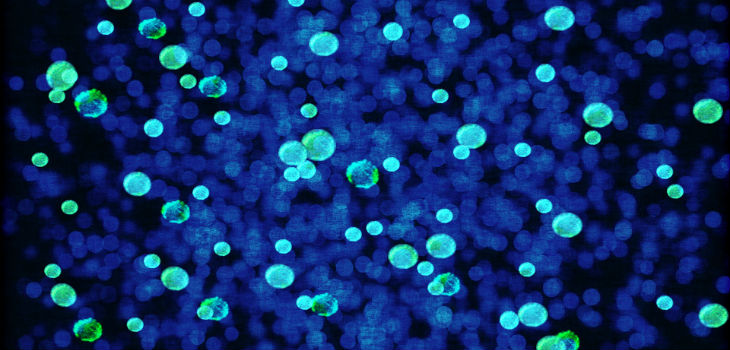 Un antibiótico utilizado en la Unión Soviética es la nueva esperanza contra las superbacterias