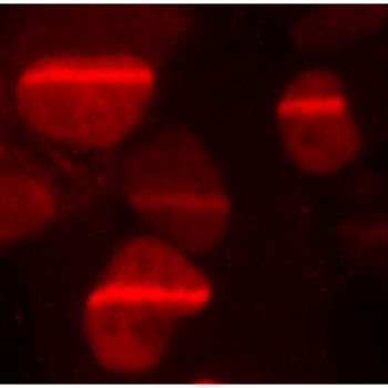 Proteína unida a las rupturas del ADN generadas con laser UV en células humanas, fotografía obtenida con microscopía de fluorescencia. 