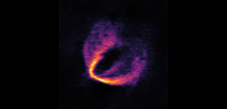 Esta imagen muestra parte del conjunto de datos de ALMA en una longitud de onda y revela un claro "estrechamiento" en el material, que indica claramente la presencia de uno de los planetas. El lugar donde se predice la ubicación del planeta está marcado con un punto azul. / ESO, ALMA (ESO/NAOJ/NRAO); Pinte et al.