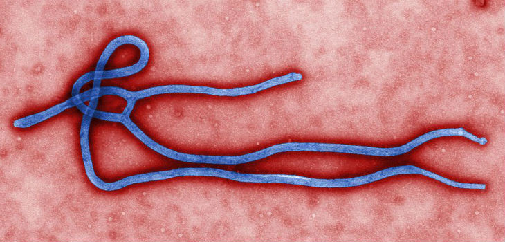 Virión del virus del Ébola. / CDC/Cynthia Goldsmith (WIKIMEDIA)