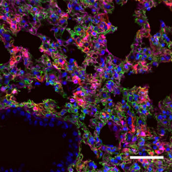Los investigadores del MIT han diseñado nanopartículas que pueden transportar y suministrar ARN mensajero a órganos específicos. En esta imagen, células de pulmón expresando el ARNm sintético, que aquí se distingue por su tonalidad rojiza. / Piotr Kowalski
