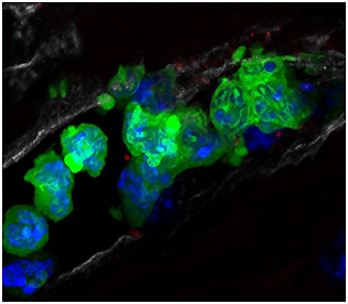 Descifran el mecanismo por el que un fármaco conocido hace décadas reduce el tamaño del infarto
