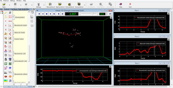 Entorno de análisis de los movimientos de la evaluación Fugl-Meyer. / Mailin Villán Villán