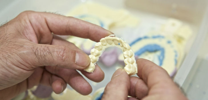 Moldes dentales de pigmeos Baka. / Roberto Ruiz (UA) 
