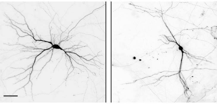 Las imágenes muestran neuronas preparadas a partir de cerebros de ratones de control (izquierda) y ratones sin el gen Nek7. Las dendritas son más cortas y están menos ramificadas en las neuronas de ratones sin NEK7. / IRB Barcelona