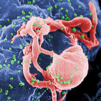 Microfotografía con MEB de VIH-1 en liberación (en verde) en un cultivo de linfocitos. Esta imagen ha sido coloreada para resaltar las características importantes; para la imagen original en blanco y negro véase PHIL 1197. Las múltiples protuberancias redondeadas sobre la superficie celular representa los sitios de ensamblado y gemación de viriones. / C. Goldsmith (WIKIPEDIA)