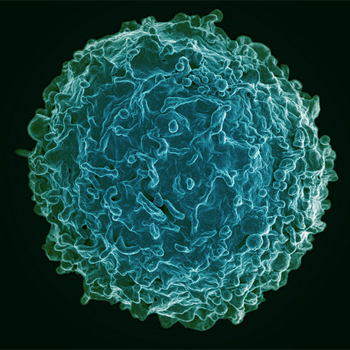 Linfocito B: micrografía de una célula B de un donante humano. / National Institutes of Allergy and Infectious Diseases, National Institutes of Health