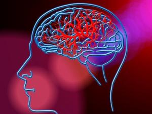 ¿Qué es un ictus? Conoce los síntomas y cómo actuar ante ellos