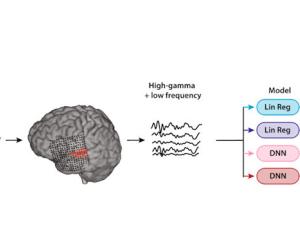 Los sujetos escucharon frases del habla natural. La población de actividad neural evocada en la corteza auditiva del oyente se utilizó para reconstruir el estímulo del habla. Los electrodos de respuesta en un tema de ejemplo se muestran en rojo<sup>1</sup>. / Hassan Akbari, et al. DOI: 10.1038/s41598-018-37359-z (CC BY 4.0)