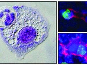 Imágenes microscópicas de macrófagos en el proceso de comerse otra célula, o con la célula ya en su interior