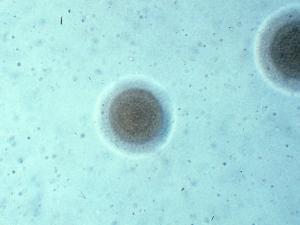 El ADN bacteriano posee la misma estructura que el resto de células vivas