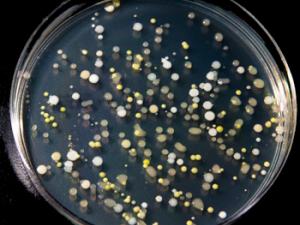 Resultado de un cultivo microbiano a partir de una muestra tomada de la superficie de un móvil. / Carlos de la Paz (FLICKR)