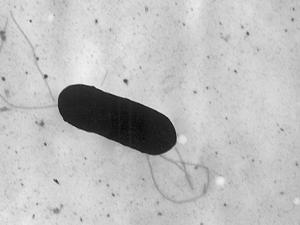 Microfotografía electrónica de una bacteria flagelada de Listeria monocytogenes, Magnified 41,250X. / Elizabeth White (WIKIMEDIA)