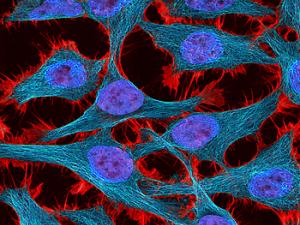 La gran capacidad proliferativa de las células cancerígenas puede ser su perdición