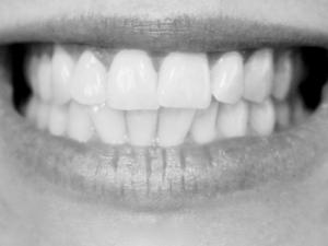 Dientes, sonrisa. / Kjerstin_Michaela (PIXABAY)