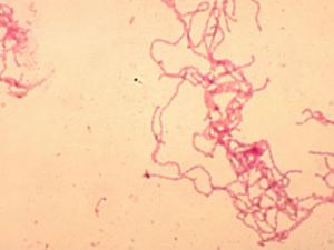 Fotomicrografía de cultivo de sangre de conejo de la bacteria Haemophilus ducreyi usando la técnica de tinción de Gram. / CDC/ Dr. Greg Hammond