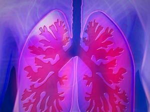 Medir los telómeros para saber cómo progresará la EPOC