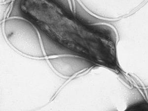 Helicobacter pylori visto al microscopio electrónico, mostrando numerosos flagelos sobre la superficie celular. / Yutaka Tsutsumi, M.D (WIKIMEDIA)