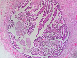 Imagen de una trompa de Falopio sana. / Ed Uthman (WIKIMEDIA COMMONS)