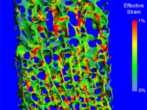Diagnosis de osteoporosis. / IBM Research (FLICKR)