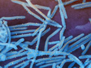 Micrografía del virus respiratorio sincitial (VRS). / NIAID (FLICKR)