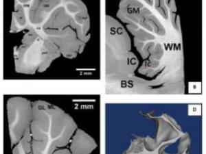 Corte de tejido cerebral. / CENIEH