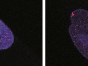 Detalle de detección de proteínas que indican daño genético en un paciente con ataxia telangiectasia. / CSIC