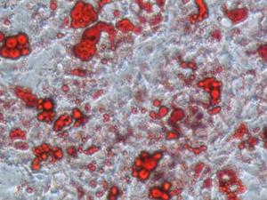 Adipocitos en cultivo, las gotadas lípidicas aparecen teñidas de rojo. / Nuria Matesanz-CNIC