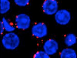 En linfocitos B (en azul en la imagen de microscopía confocal), la proximidad entre receptores (BCRs) se analiza mediante una técnica llamada PLA (del inglés, “Proximity Ligation Assay”) que genera señales fluorescentes en rojo cuando los receptores están una distancia menor de 20 nanómetros. / Kathrin Kläsener (CNIC)