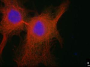 La sobreexpresión de PLK1 provoca un defecto en la separación de las células después de su división, impidiendo la proliferación celular y el crecimiento tumoral. / CNIO