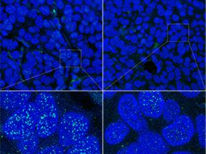 Niveles de TRF1 en el telómero en muestras de PDX sin tratar (izq.) y tratados con un inhibidor de PI3K (drch.)./ CNIO