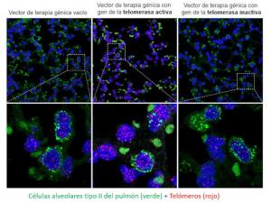 Imágenes de pulmones tratados con los vectores de terapia génica en las que se observan los núcleos de las células en azul, las células alveolares en verde y los telómeros en rojo. Se observan que los telómeros de las células de pulmón a los que se les ha tratado con la telomerasa activa son más intensos indicando mayor longitud telomérica que las células de pulmones tratados con los vectores vacíos o con la telomerasa inactiva. /CNIO