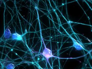 Neuronas. / Ardy Rahman-UCI Research (FLICKR)