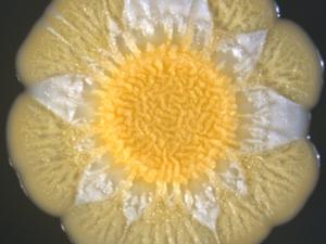 Colonia de S. aureus crecida durante 5 días diversificando subpoblaciones (con pigmentación diferente). / CSIC